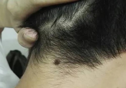 胃炎有哪些症状表现,胃炎怎么调理才能痊愈
